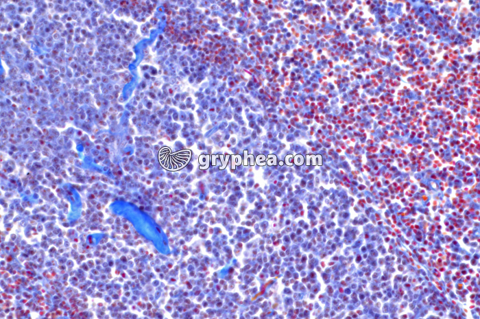 Ganglion lymphatique x160 - gryphea.org